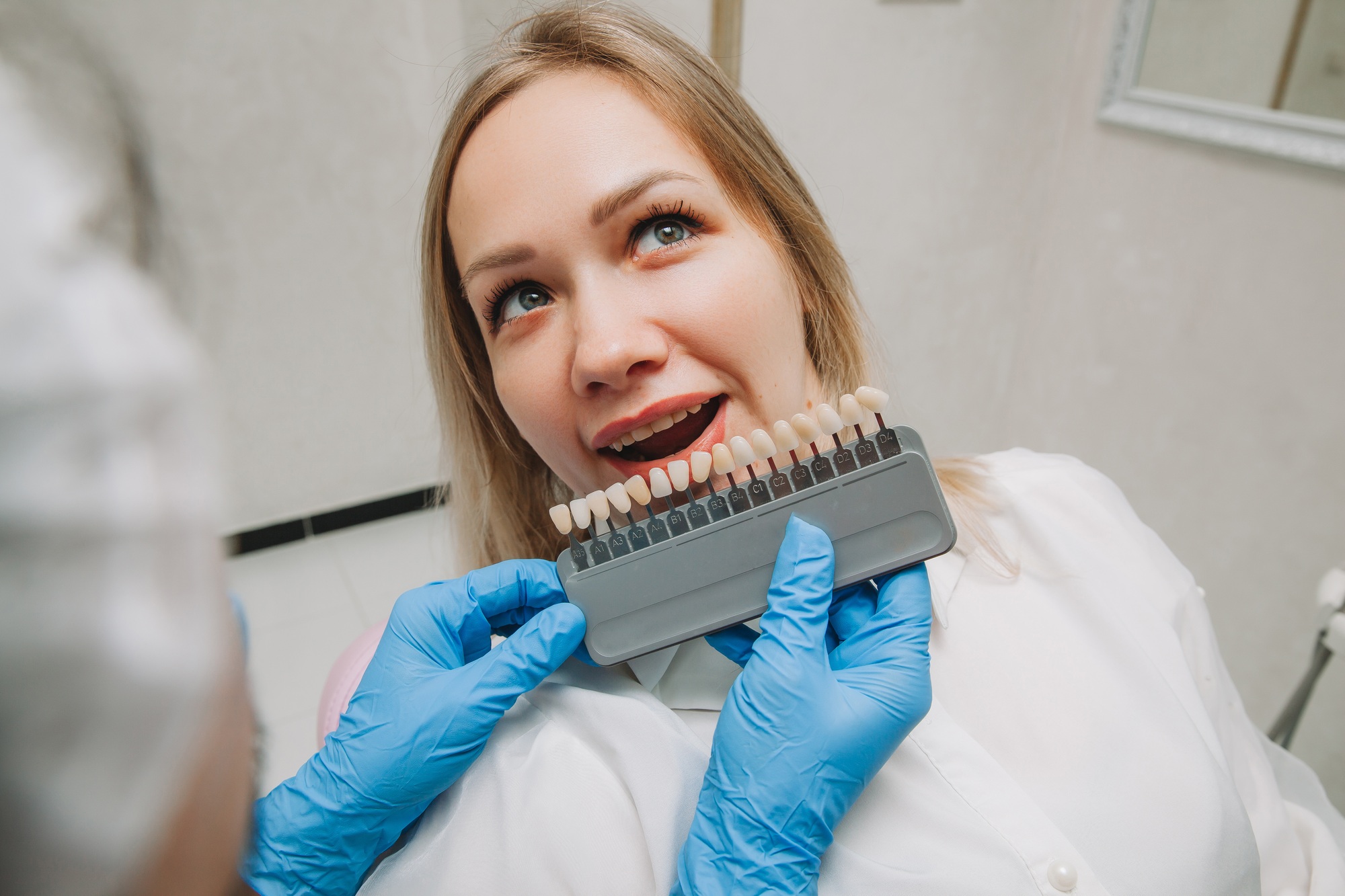 Selection of the correct tooth color for professional cosmetic whitening at the dentist.